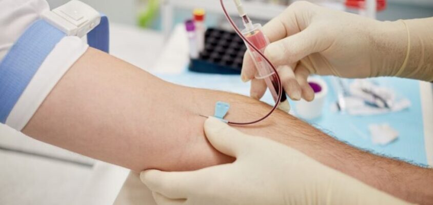 hepatites