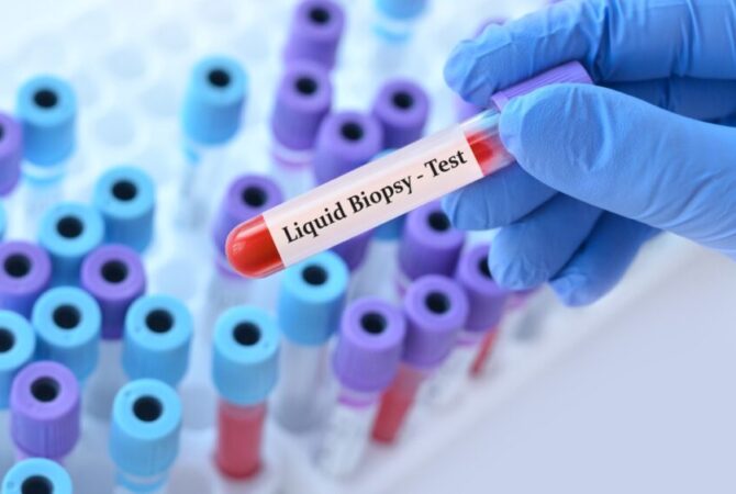 biopsia líquida