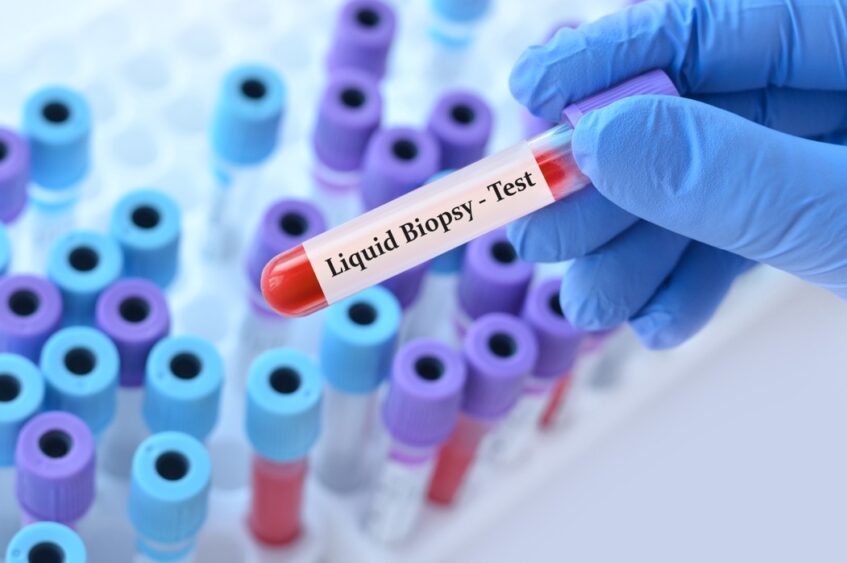 Biópsia líquida e o diagnóstico do câncer​