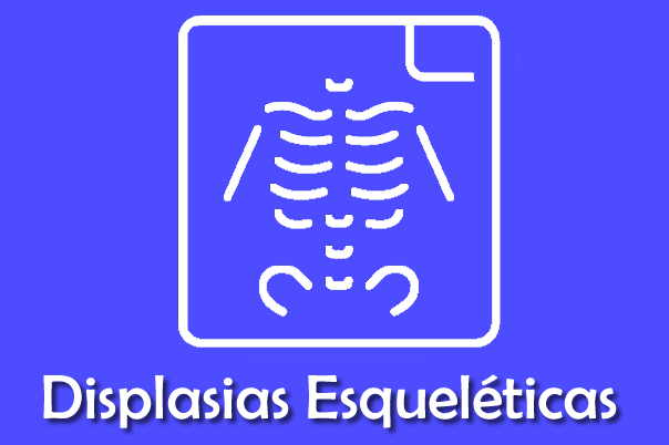 Displasia Esqueléticas